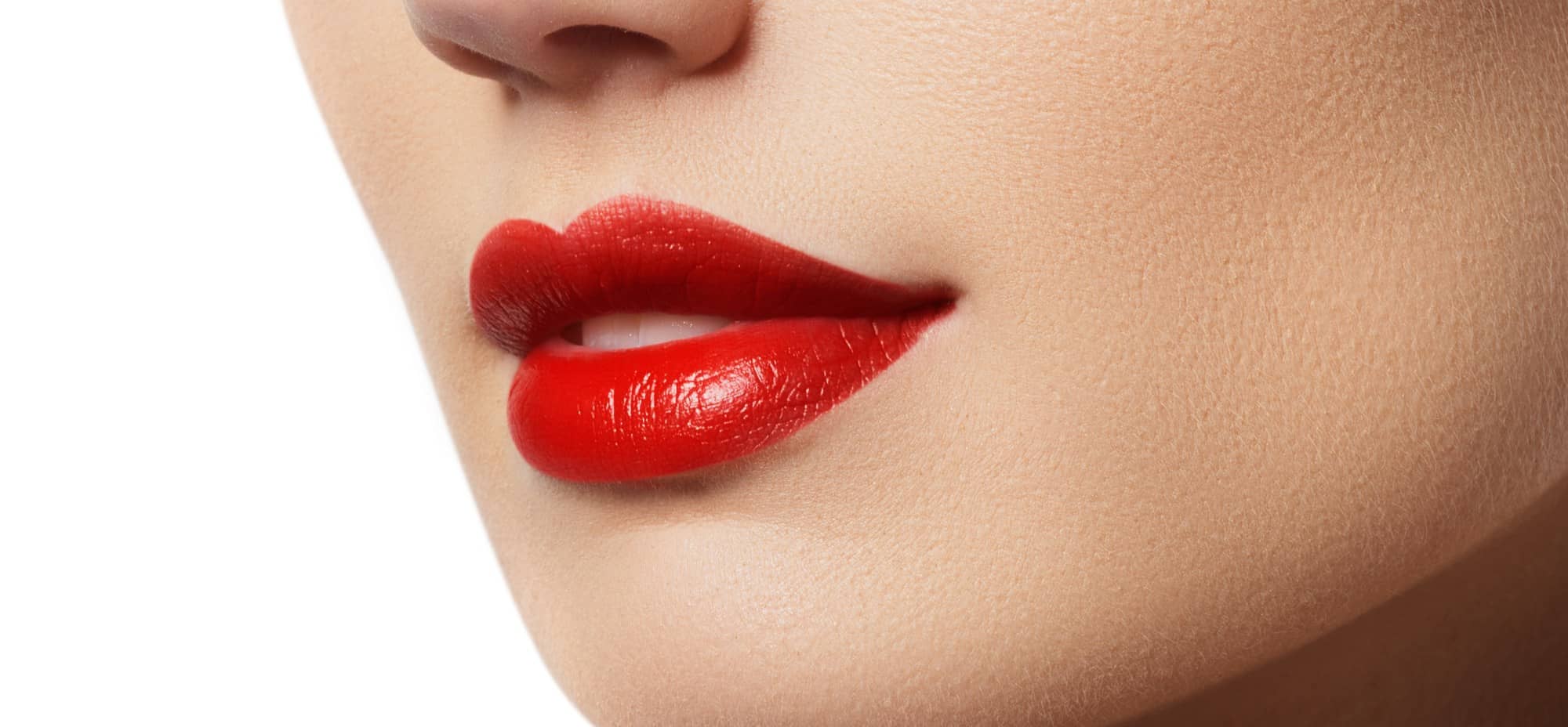 Les Russian lips : des lèvres pulpeuses sans chirurgie ! | Dr Cornil | Nice